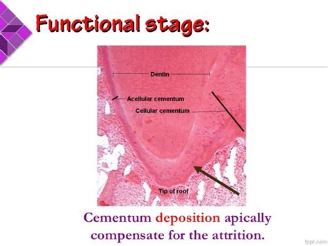 Cementum