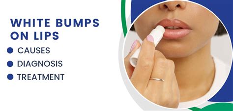 White Bumps on Lips: Causes, Diagnosis, and Treatment