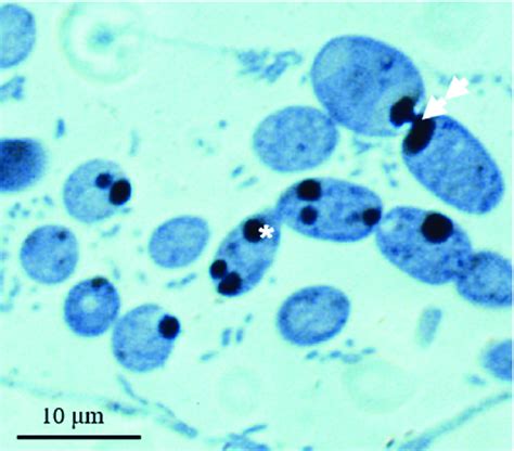 Coomassie brilliant blue staining following fixation with Ga-OsO 4 .... | Download Scientific ...