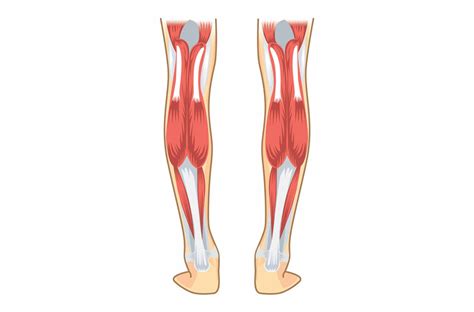 Tennis leg (calf muscle tear) - Ultrasound Guided Injections