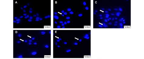 Morphological changes and induction of chromatin condensation in AGS ...