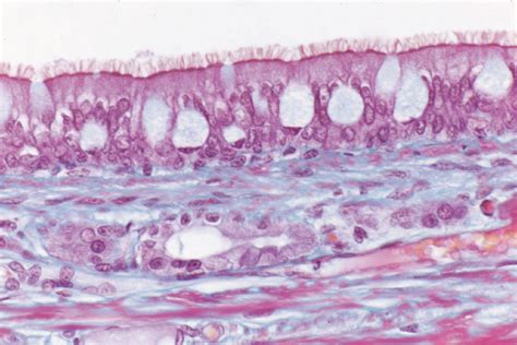 Pseudostratified Columnar Epithelium Histology Histology Slides ...