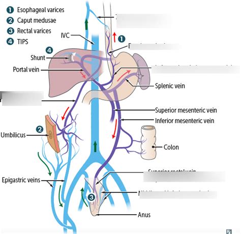 Superficial Epigastric Vein Anastomosis