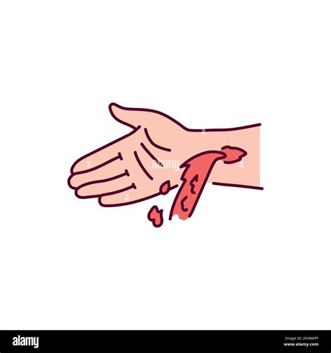 Arterial bleeding from hand color line icon. Injuries concept Stock Vector Image & Art - Alamy