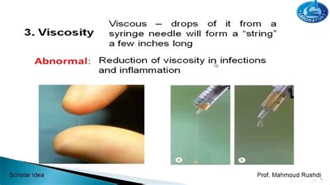 Synovial fluid analysis normal values - vebery