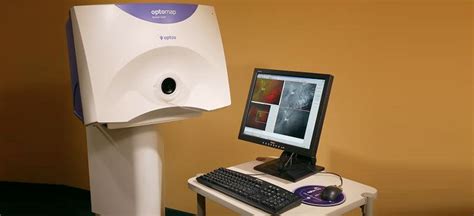 Optos Retinal Exams | Advanced Optometry | Westlake Village, CA