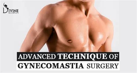 Advanced Treatment of Gynecomastia, Surgery by Dr. Amit Gupta