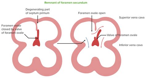 Development of the Heart | Concise Medical Knowledge