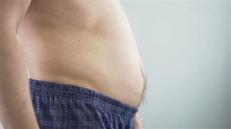 Rash under folds of stomach: Causes, symptoms, pictures, and treatment