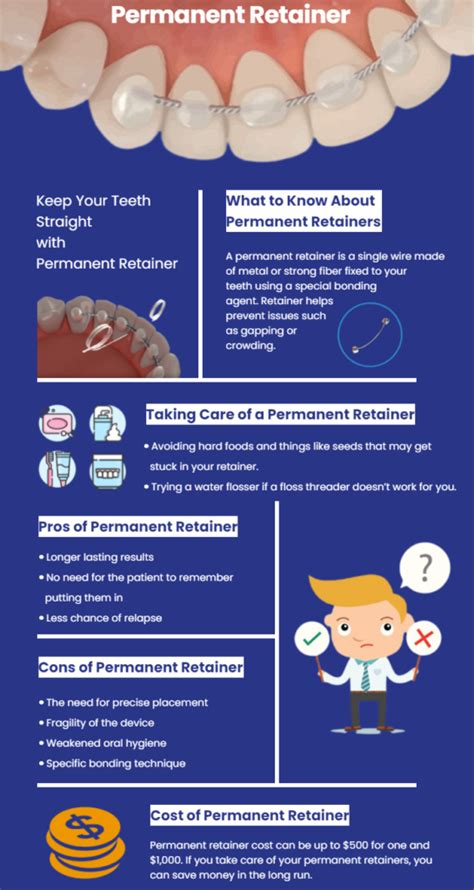 A Permanent Retainer for Permanent Smile | Pros, Cons and Cost