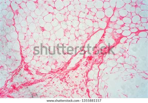 Human Fat Body Tissue Under Microscope Stock Photo (Edit Now) 1355881157