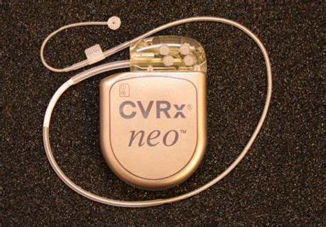 CVRx Barostim Neo Implantable Device | Dandy Gadget