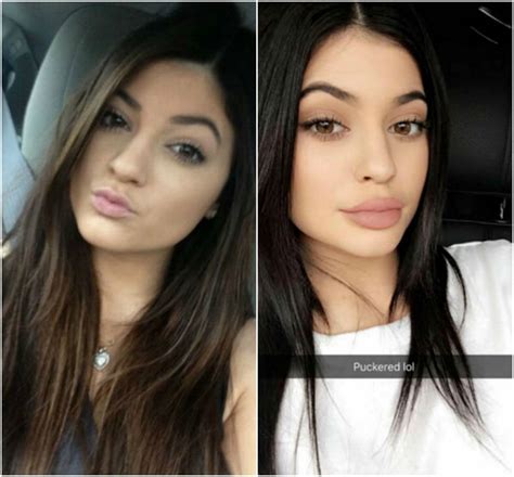 Kylie Jenner's Lips - Before and After Pictures of Her Pout