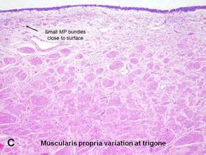 American Urological Association - Urinary Bladder: Muscularis Propria