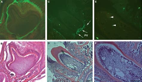 Figure 1 from Defining a visual marker of osteoprogenitor cells within the periodontium ...