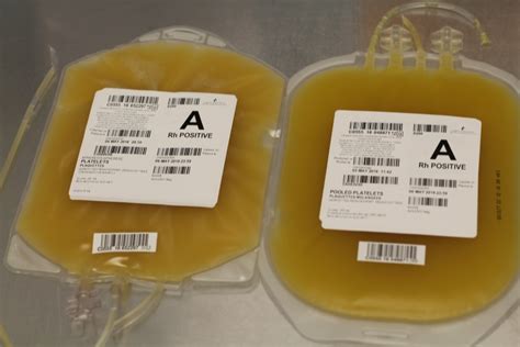 Platelet transfusion, alloimmunization and management of platelet ...