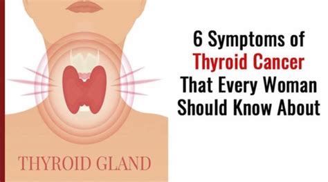 6 Symptoms of Thyroid Cancer That Every Woman Should Know About.