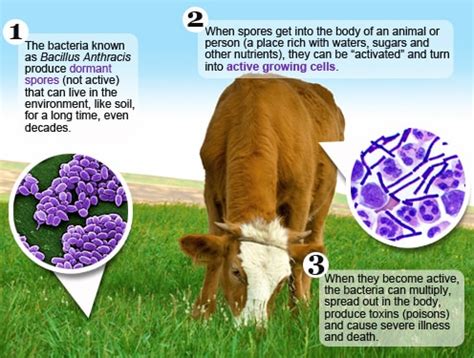 Basic Information | Anthrax | CDC