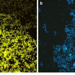 52-year old woman with 2 days of acute cystitis. a E.coli bacteriuria ...