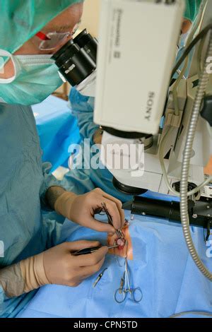 STRABISMUS, SURGERY Stock Photo, Royalty Free Image: 48408760 - Alamy