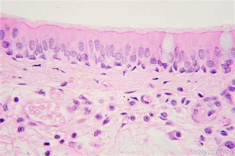 Pseudostratified Columnar Epithelium