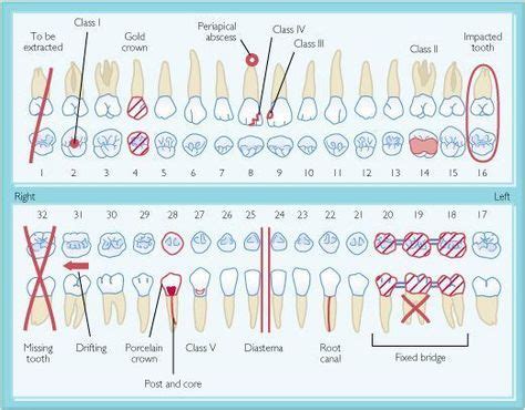 Stimulating Dental Crown Front Teeth #DentalImplantsSurgery # ...