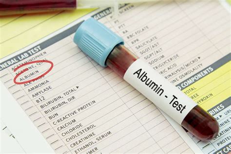 Albumin Blood Test: Uses, Normal and Abnormal Levels