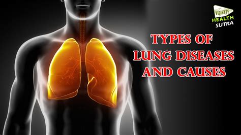 Types of Lung Diseases and Causes - Health Sutra - YouTube