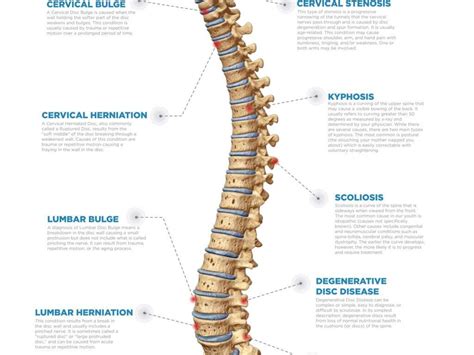 Arm Pain: 10 Causes of Arm Pain