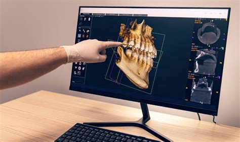 The Emergence Of teledentistry: The Benefits And Limitations