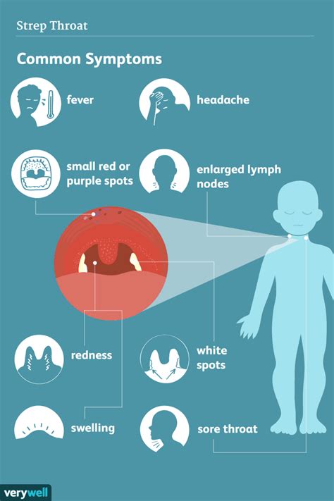 Strep Throat: Signs, Symptoms, and Complications