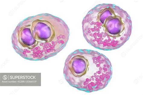 Cytomegalovirus infection, illustration - SuperStock