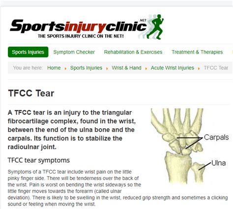 Pin on Ulnar-Sided Wrist Pain & TFCC Injuries