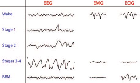 Representative EEG, EMG and EOG readouts during an awake and sleep ...