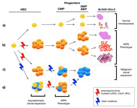 How are myeloproliferative neoplasms (MPNs) made from stem cells? What ...