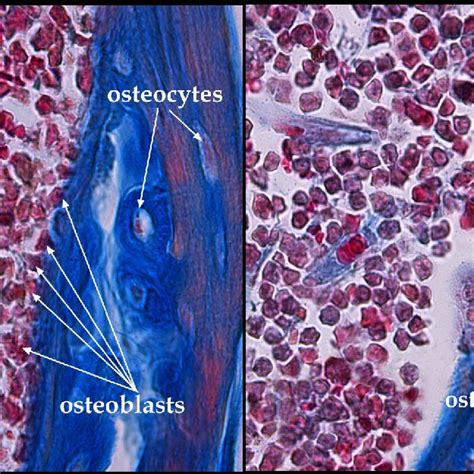 Bone cells-osteoblasts, osteocytes and osteoclasts; unpublished image... | Download Scientific ...