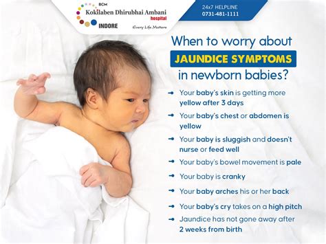 When to worry about jaundice symptoms in newborn babies?