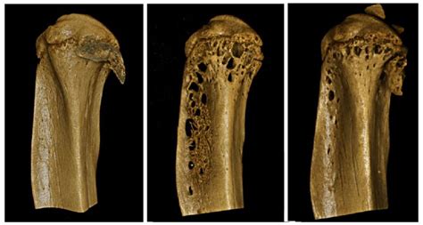 Bones [IMAGE] | EurekAlert! Science News Releases