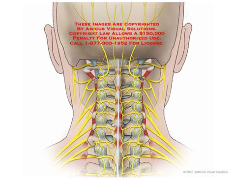 AMICUS Illustration of amicus,anatomy,cervical,neck,posterior,nerves,C1 ...