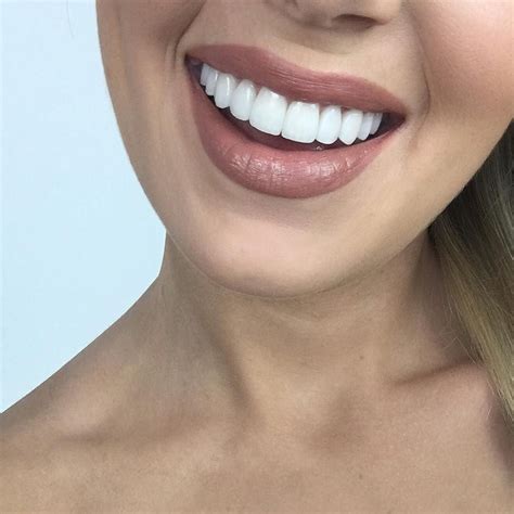 The 25+ best Beautiful teeth ideas on Pinterest | Whitening, Teeth whitening diy and Smile whitening