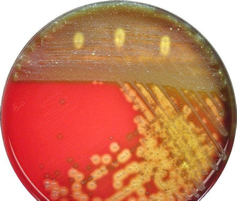 STREPTOCOCCUS PYOGENES | All Microbes