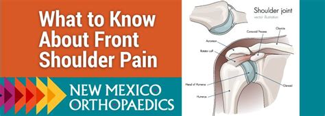 What to Know About Front Shoulder Pain - New Mexico Orthopaedic Associates