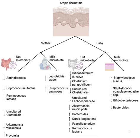 Microorganisms | Free Full-Text | The Role of Early Life Microbiota ...