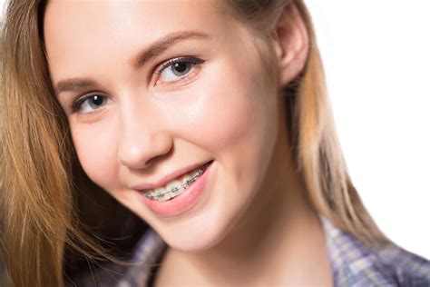 Overbite vs. Underbite: A Beginner's Overview