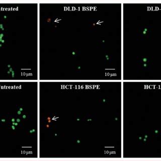 Fluorescence imaging for demonstration of cell death by treatment of... | Download Scientific ...