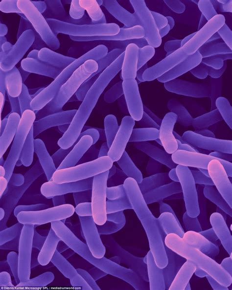 GUT - GOOD BACTERIA: An SEM of a Bifidobacterium animalis, a probiotic bacterium. Pictured ...