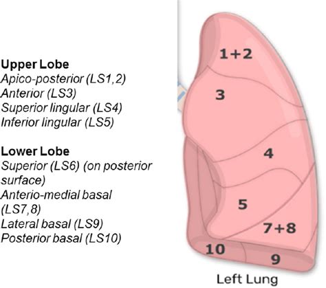 The technique of robotic anatomic pulmonary segmentectomy II: left ...