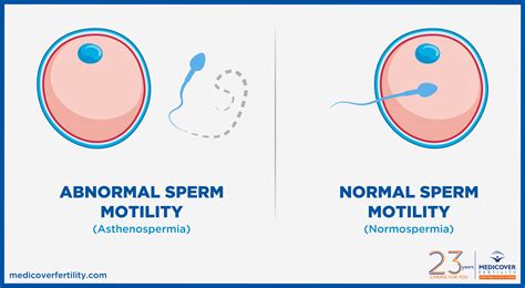 Sperm motility: normal and low motility explained | Clearblue