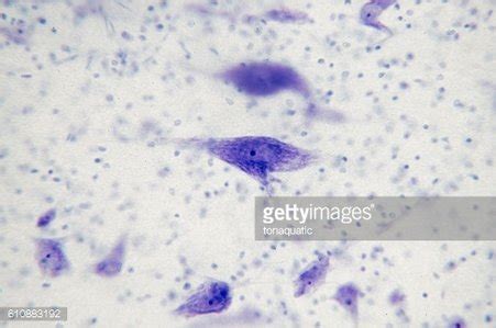 Neurons In The Brain From Microscope.(Soft Focus) Stock Clipart ...