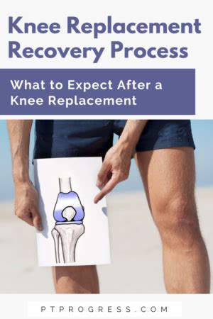 Total Knee Replacement Recovery: What to Expect After Knee Replacement